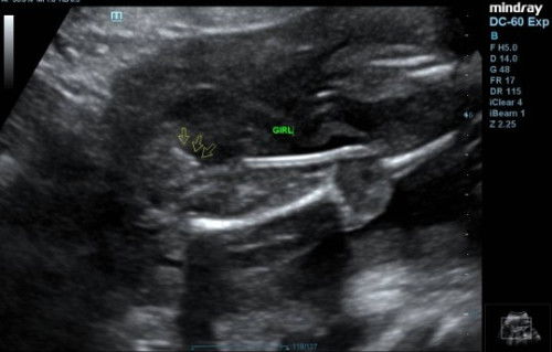 Mengesahkan jantina baby