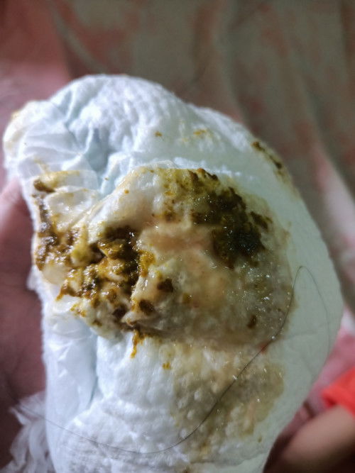 Fases ijo dan berlendir