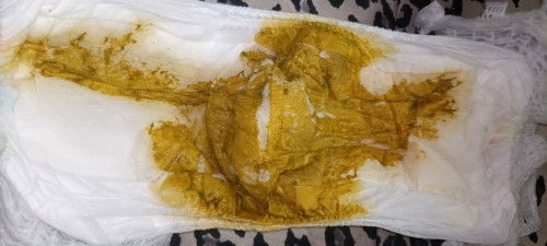 Mencret apa fasenya?