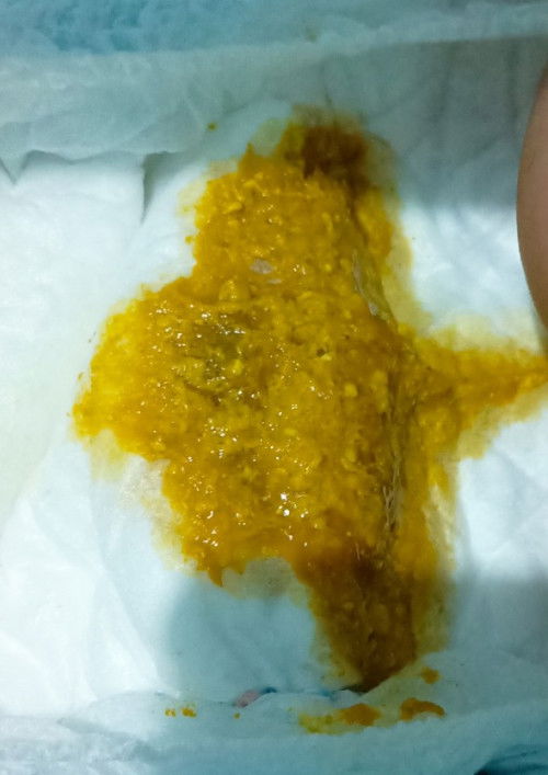 BAB bayi berlendir coklat