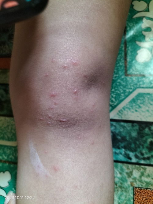 alergi atau apa yaa ??