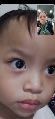 Prng kuliti sa mata ni baby po ano po bng gamot?Binigyan po kme ni pedia kya lng po prang lumaki po