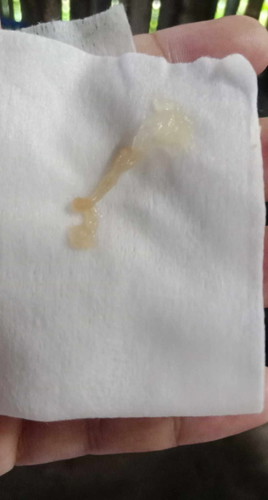 mucus plug na po kaya ito? 38weeks and 3days napo ako now.