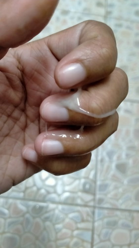 ประจำเดือนเลื่อน