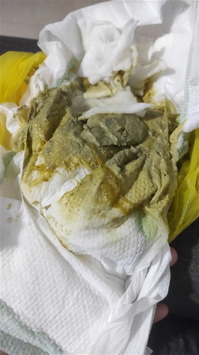 Mucus in Poop