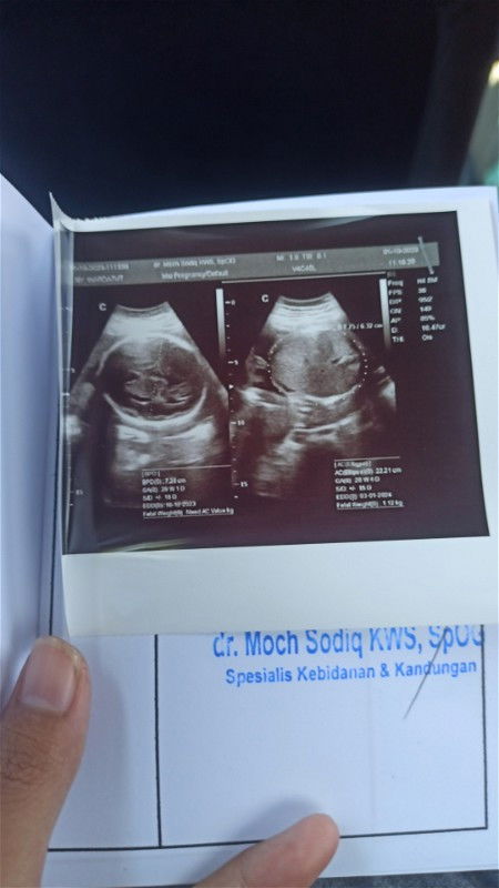 BBJ UK 28 week 1,2 kg