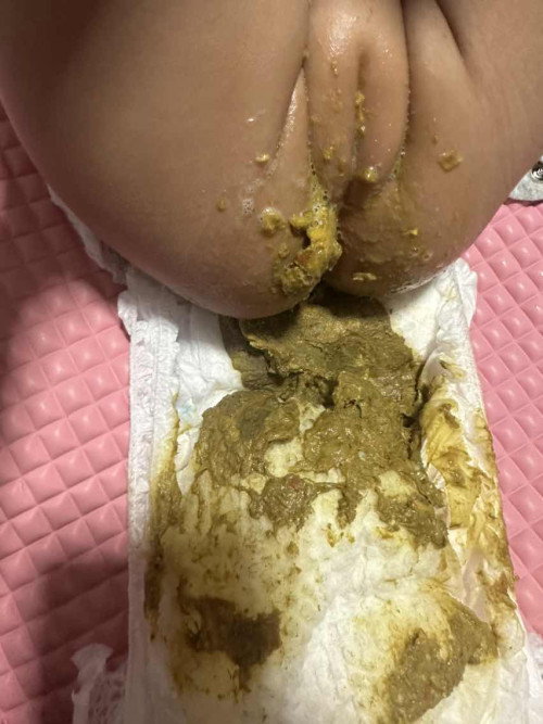 Red spots in baby’s poo