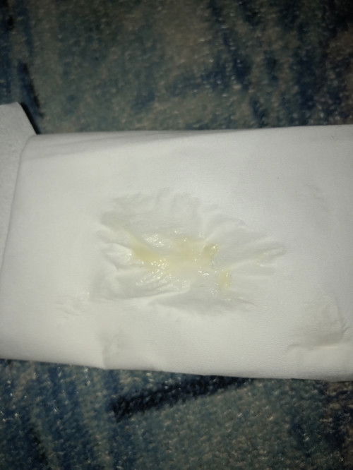 Keluar lendir dengan tekstur kental di usia kehamilan 36 minggu 4 hari