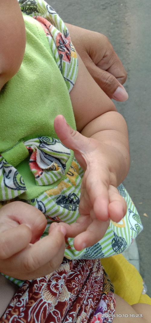 Jari bayi tumpang tindih