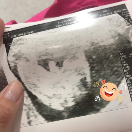 19w+1d👶🏻ไม่คิดว่าจะถ่างให้ดูขนาดนี้555