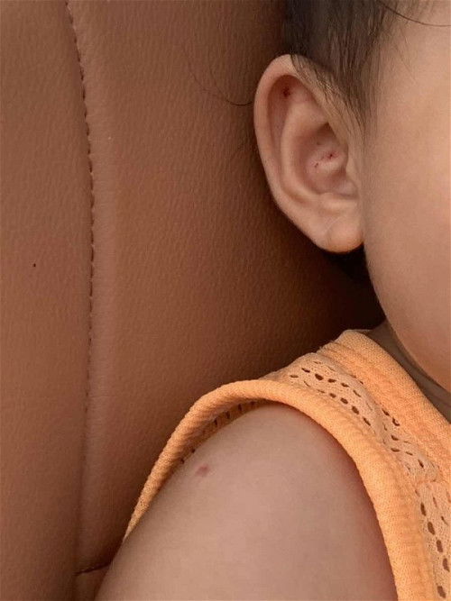 ลูกน้อย1ขวบชอบเกาหู