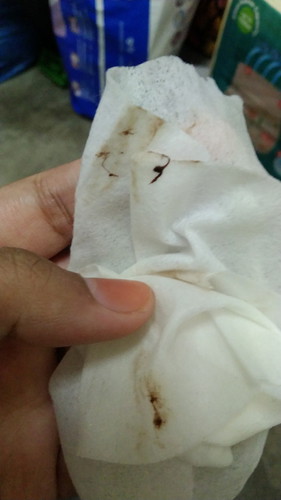 kandungan baru 5minggu plus