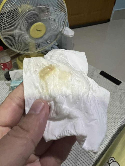 มูกแบบในรูปคือมูกอะไรคะ