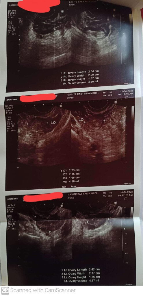 Hoping for baby
