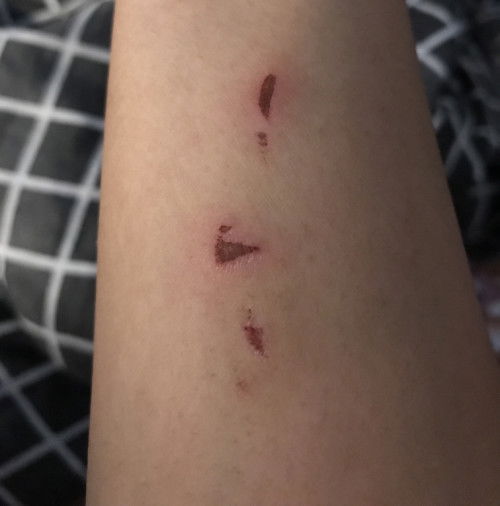 Suami sering main tangan ketika ribut