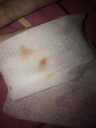 เลือดออกควรไปหาหมอมั้ยคะ