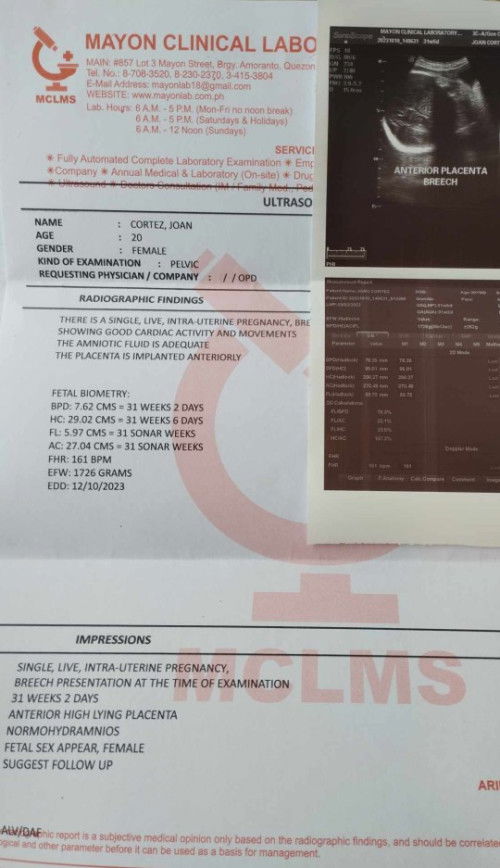 31weeks preggybbreech padin po si baby.😢