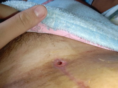 Sino nakaranas ng ganito among ginawa at suggest ng doctor sa Inyo?