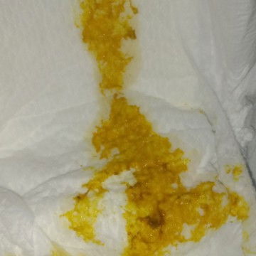 bab bayi usia 1 bulan 14hari