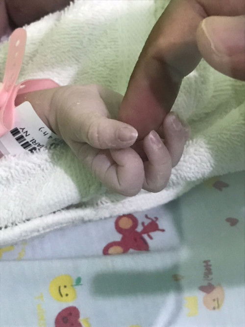 Lahir SC Metode Eracs