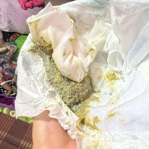 NORMAL KE TAHI BERWARNA MACAM NI