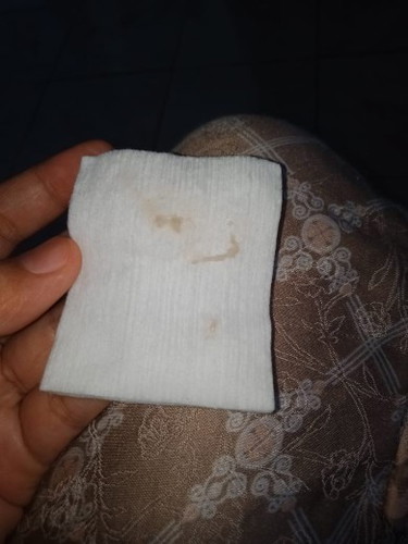 Keluar flek coklat tapi sedikit umur kandungan 10 minggu bun, kadang2 warna putih seperti keputihan