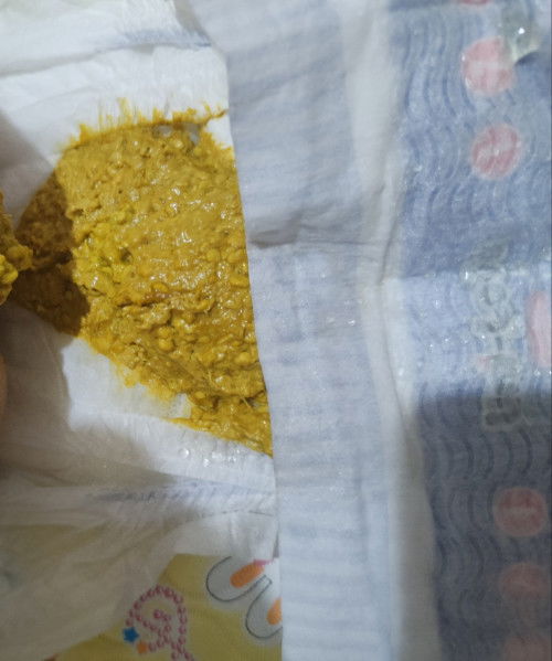 May bilog bilog sa dumi