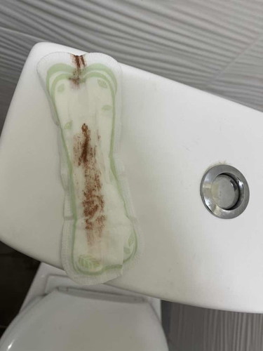 Bleeding/miscarriage