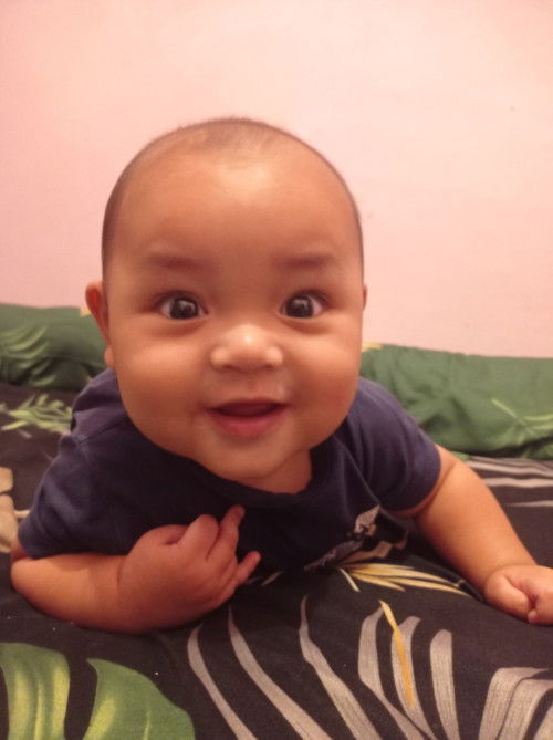 Mata bayi agak Juling