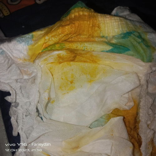 Najis baby warna kuning NORMAL @TIDAK...??