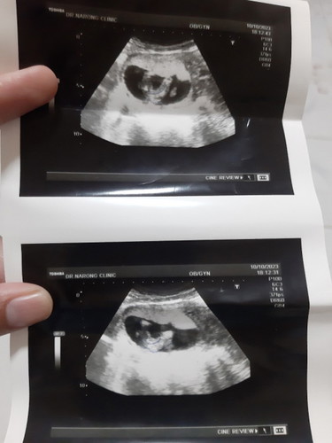 อยากทราบเพศลูก