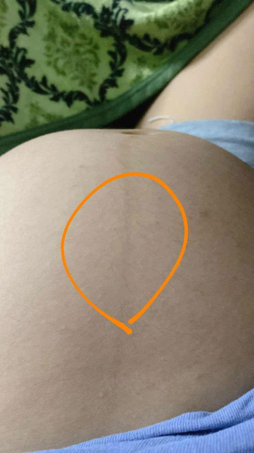 เจ็บกลางท้อง