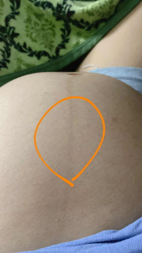 เจ็บกลางท้อง