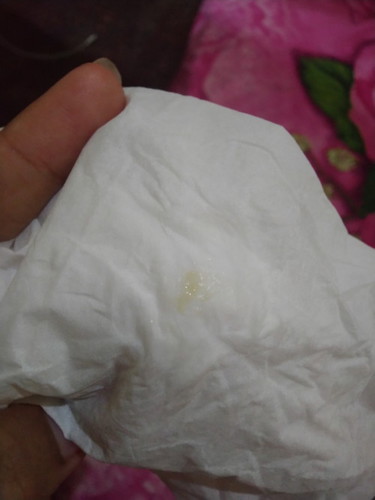 Bund ada yg pernah ngalamin keputihan gini ngga?uk 6w6d ga gatel & ga bau.
Pake obat apa ya bund