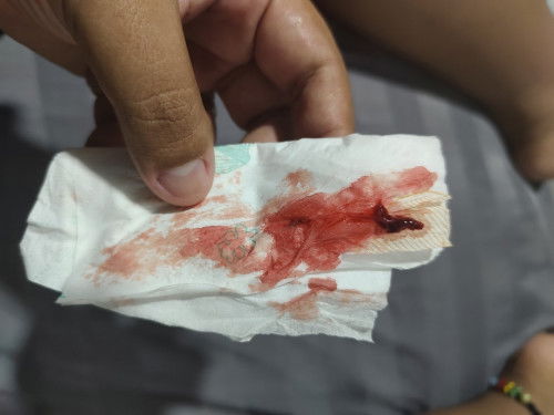 ปวดท้องมีเลือดออก