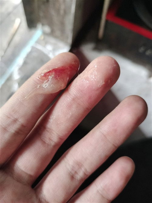 อาการเตือน