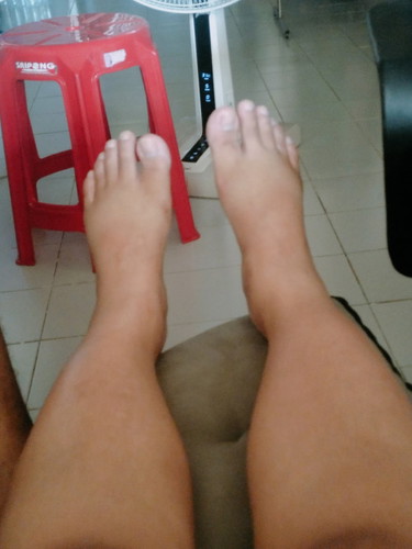 เท้าเริ่มบวม