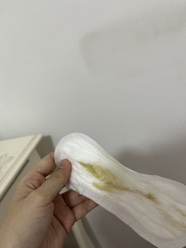 Keputihan hijau