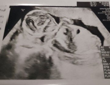 ใครพอดูออกมั้ยคะ