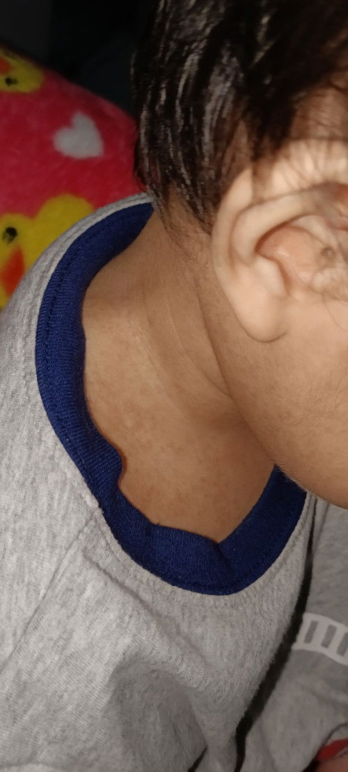 Ano po kaya ito mga mommy?