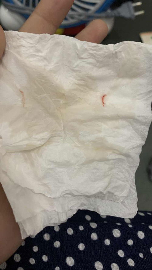 Keluar darah usia 7w