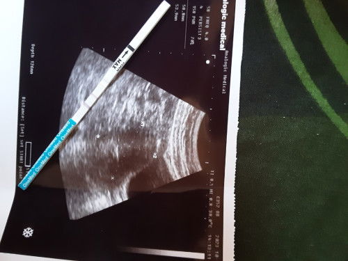 HPHT 31 Agustus, 3 harian ini sempet ngeluarin kyk lendir, dan USG masih penebalan dinding