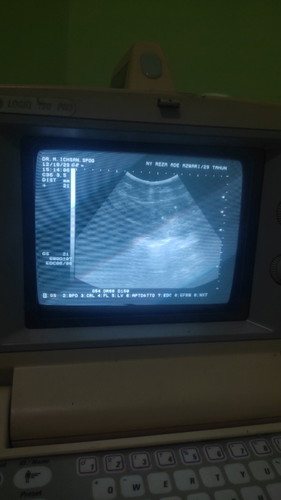 Ada yang sama ga Bun hamil 6 weeks baru kelihatan kantong kehamilan saja