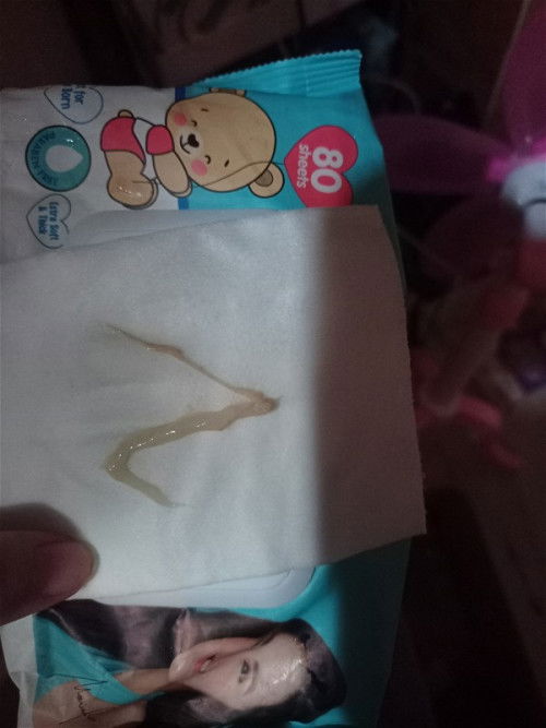 39&2 days still no sign of labour 😞