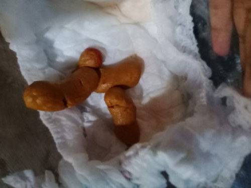 bayi 5 bulan 10 hari susah pup, knp?