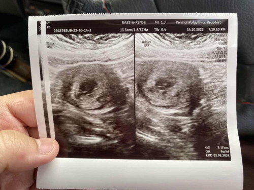 Preggy 6w 5d