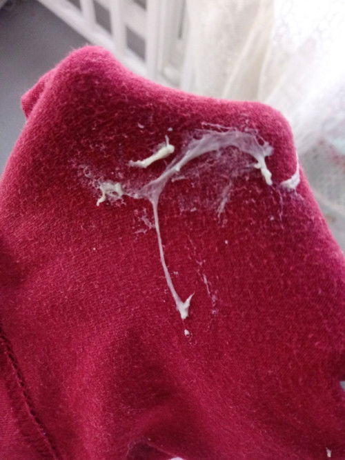 Normal po ba ganito na discharge ? Ano po kaya to ?