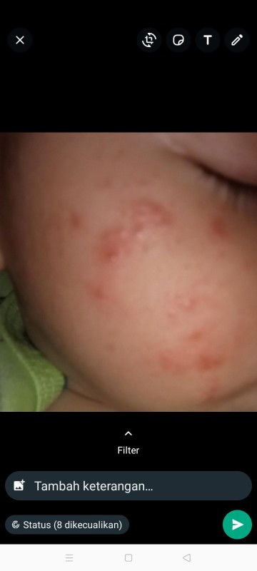 Serius tanya Bun🙏🙏