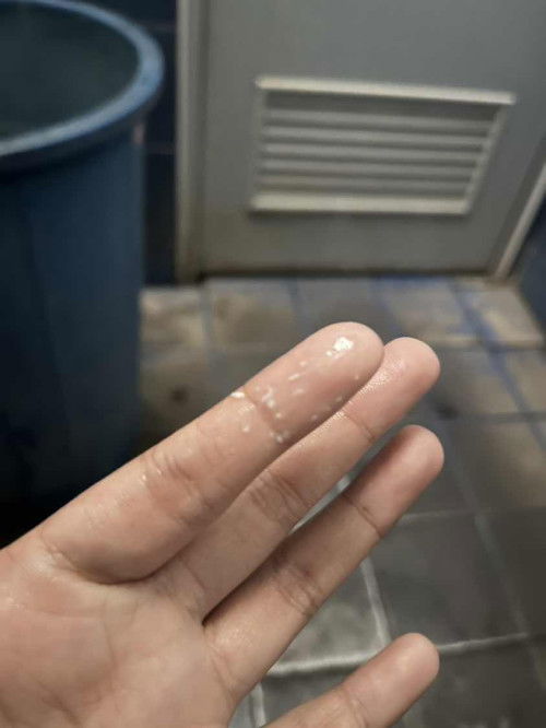 ตกขาวแบบนี้อันตรายไหมคะ