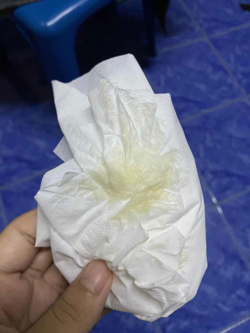 หลังคลอดมีเมือกออกทางช่องคลอด